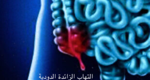 التهاب الزائده الدوديه